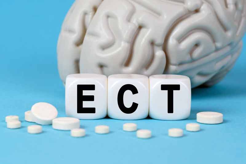 Electroconvulsive therapy cost
